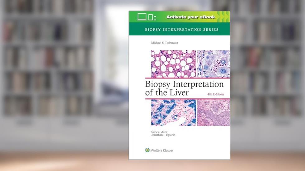 Biopsy Interpretation of the Liver (Biopsy Interpretation Series), written by Michael Torbenson MD
