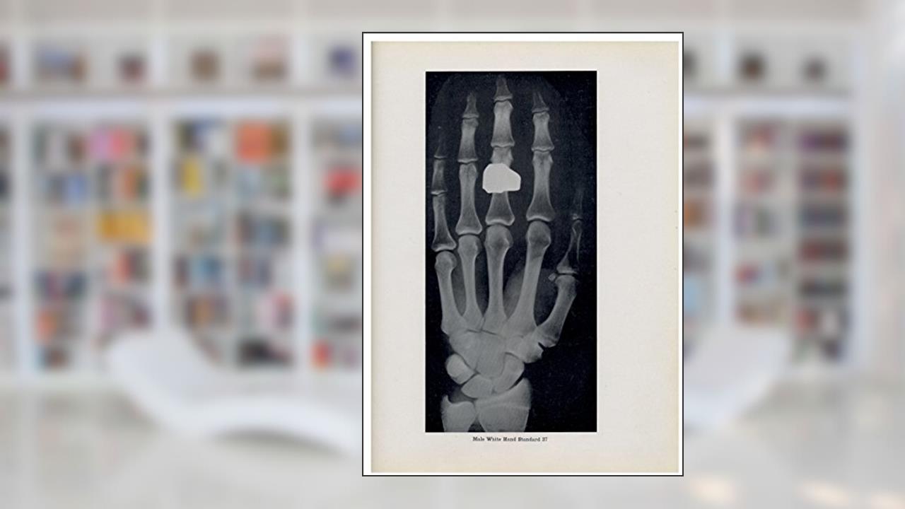 Atlas of Skeletal Maturation., written by T. Wingate Todd