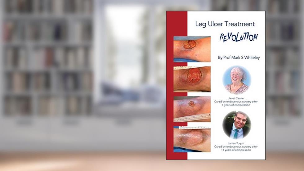 Leg Ulcer Treatment Revolution, written by Mark S Whiteley