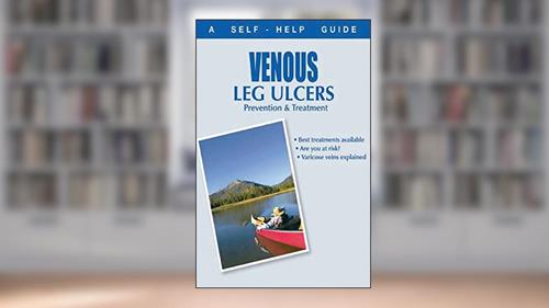 Cover from The Doctor's Guide to: Venous Leg Ulcers: Prevention and Treatment (Dr. Guide Books), written by Kenneth Wright