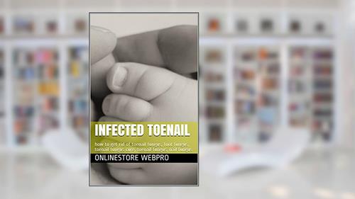Cover from Infected Toenail: how to get rid of toenail fungus, foot fungus, toenail fungus cure, toenail fungus, nail fungus, written by OnlineStore WebPro
