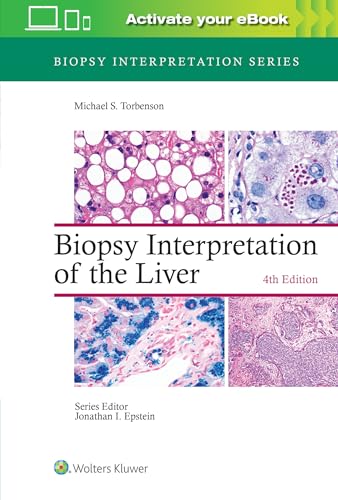 Read Biopsy Interpretation of the Liver (Biopsy Interpretation Series), written by Michael Torbenson MD