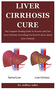 Liver Cirrhosis Cure: The Complete Healing Guide To Reverse And Cure Liver Cirrhosis; Everything You Need To Know About Liver Cirrhosis, written by Dr. Jeffrey Adler