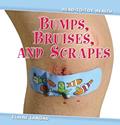 Read Bumps, Bruises, and Scrapes (Head-to-toe Health, 1), written by Elaine Landau