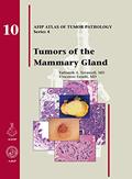 Read Tumors of the Mammary Gland (AFIP Atlas of Tumor Pathology, Series 4), written by Fattaneh A. Tavassoli; V. Eusebi Read Tumors of the Mammary Gland (AFIP Atlas of Tumor Pathology, Series 4), written by Fattaneh A. Tavassoli; V. Eusebi