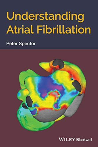 Read Understanding Atrial Fibrillation, written by Peter Spector