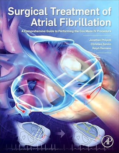 Read Surgical Treatment of Atrial Fibrillation: A Comprehensive Guide to Performing the Cox Maze IV Procedure, written by Jonathan Philpott MD; Christian Zemlin; Ralph J. Damiano Read Surgical Treatment of Atrial Fibrillation: A Comprehensive Guide to Performing the Cox Maze IV Procedure, written by Jonathan Philpott MD; Christian Zemlin; Ralph J. Damiano
