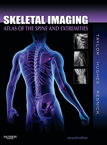Read Skeletal Imaging: Atlas of the Spine and Extremities, written by John A. M. Taylor; Tudor H. Hughes; Donald Resnick