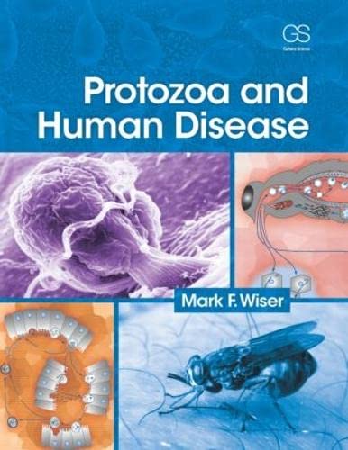 Read Protozoa and Human Disease, written by Mark F Wiser