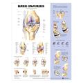 Read Knee Injuries Anatomical Chart, written by ACC