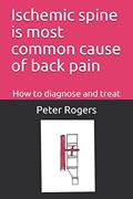 Read Ischemic spine is most common cause of back pain: How to diagnose and treat, written by Peter Rogers MD Read Ischemic spine is most common cause of back pain: How to diagnose and treat, written by Peter Rogers MD