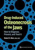 Read Drug-induced Osteonecrosis of the Jaws: How to Diagnose, Prevent, and Treat It, written by Robert E. Marx