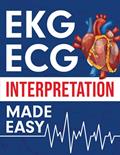 Read EKG | ECG Interpretation Made Easy: An Illustrated Study Guide For Students To Easily Learn How To Read & Interpret ECG Strips, written by NEDU