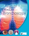Read Atlas of Flexible Bronchoscopy, written by Pallav Shah