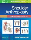 Read Shoulder Arthroplasty: Principles and Practice, written by Joseph D. Zuckerman MD