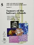 Read Tumors of the Salivary Glands: Series 5, written by Justin A Bishop Read Tumors of the Salivary Glands: Series 5, written by Justin A Bishop