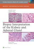Read Biopsy Interpretation of the Kidney & Adrenal Gland (Biopsy Interpretation Series), written by Satish Tickoo; Ying-Bei Chen; Debra Zynger Read Biopsy Interpretation of the Kidney & Adrenal Gland (Biopsy Interpretation Series), written by Satish Tickoo; Ying-Bei Chen; Debra Zynger