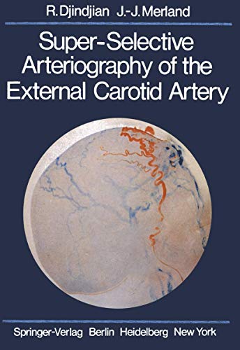 Read Super-Selective Arteriography of the External Carotid Artery, written by Rene Djindjian; J.-J. Merland Read Super-Selective Arteriography of the External Carotid Artery, written by Rene Djindjian; J.-J. Merland
