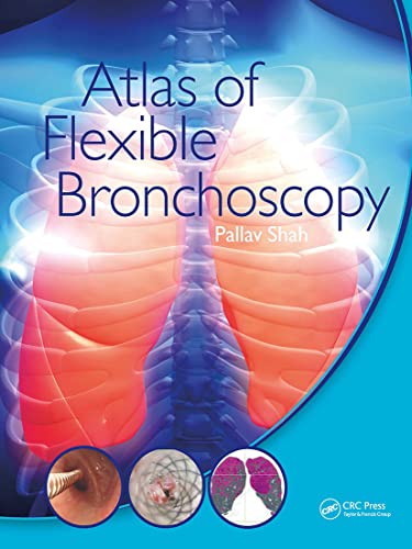 Read Atlas of Flexible Bronchoscopy, written by Pallav Shah Read Atlas of Flexible Bronchoscopy, written by Pallav Shah