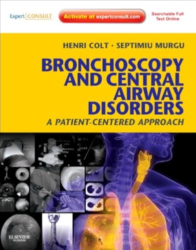 Read Bronchoscopy and Central Airway Disorders: A Patient-Centered Approach: Expert Consult Online and Print, written by Henri Colt; Septimiu Murgu Read Bronchoscopy and Central Airway Disorders: A Patient-Centered Approach: Expert Consult Online and Print, written by Henri Colt; Septimiu Murgu