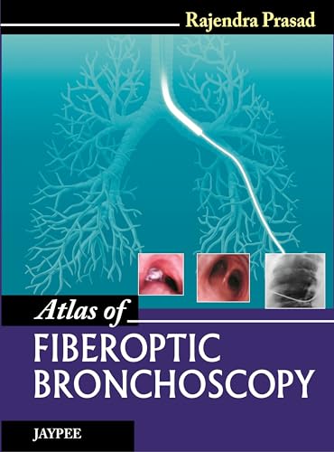 Read Atlas of Fiberoptic Bronchoscopy, written by Prasad, Rajendra, M.D.