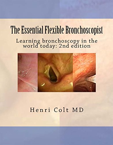 Read The Essential Flexible Bronchoscopist: Learning bronchoscopy in the world today (The Essential Bronchoscopist), written by Henri Colt Read The Essential Flexible Bronchoscopist: Learning bronchoscopy in the world today (The Essential Bronchoscopist), written by Henri Colt
