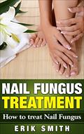 Read Nail Fungus Treatment: A beginners guide to Nail Fungus Treatment, written by Erik Smith