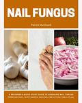 Read Nail Fungus: A Beginner's Quick Start Guide to Managing Nail Fungus Through Diet, With Sample Recipes and a 7-Day Meal Plan, written by Patrick Marshwell