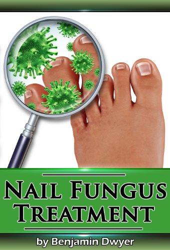 Read Nail Fungus Treatment, written by Benjamin Dwyer Read Nail Fungus Treatment, written by Benjamin Dwyer