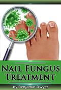 Read Nail Fungus Treatment, written by Benjamin Dwyer