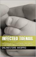 Read Infected Toenail: how to get rid of toenail fungus, foot fungus, toenail fungus cure, toenail fungus, nail fungus, written by OnlineStore WebPro