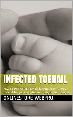 Infected Toenail: how to get rid of toenail fungus, foot fungus, toenail fungus cure, toenail fungus, nail fungus, written by OnlineStore WebPro