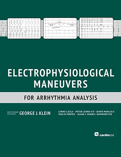 Read Electrophysiological Maneuvers for Arrhythmia Analysis, written by George J. Klein Read Electrophysiological Maneuvers for Arrhythmia Analysis, written by George J. Klein