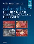 Read Color Atlas of Oral and Maxillofacial Diseases, written by Brad W. Neville DDS; Douglas D. Damm DDS; Carl M. Allen DDS MSD; Angela C. Chi DMD Read Color Atlas of Oral and Maxillofacial Diseases, written by Brad W. Neville DDS; Douglas D. Damm DDS; Carl M. Allen DDS MSD; Angela C. Chi DMD