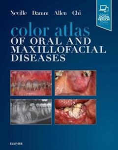 Color Atlas of Oral and Maxillofacial Diseases, written by Brad W. Neville DDS; Douglas D. Damm DDS; Carl M. Allen DDS  MSD; Angela C. Chi DMD