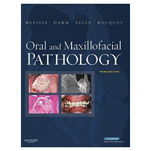 Read Oral and Maxillofacial Pathology, 3rd Edition, written by Brad W. Neville; Douglas D. Damm; Carl M. Allen; Jerry E. Bouquot Read Oral and Maxillofacial Pathology, 3rd Edition, written by Brad W. Neville; Douglas D. Damm; Carl M. Allen; Jerry E. Bouquot