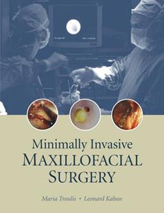Minimally Invasive Maxillofacial Surgery, written by Troulis; Maria J Troulis Dds Msc
