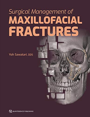 Read Surgical Management of Maxillofacial Fractures, written by Yoh Sawatari Read Surgical Management of Maxillofacial Fractures, written by Yoh Sawatari