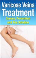 Read Varicose Veins Treatment, written by William Gray