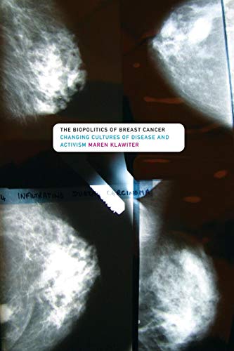 Read The Biopolitics of Breast Cancer: Changing Cultures of Disease and Activism, written by Maren Klawiter Read The Biopolitics of Breast Cancer: Changing Cultures of Disease and Activism, written by Maren Klawiter