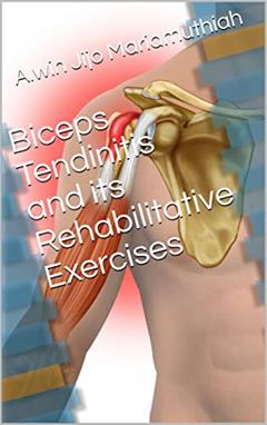 Biceps Tendinitis and its Rehabilitative Exercises, written by Alwin Jijo Mariamuthiah