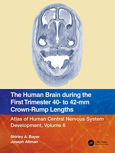 Read The Human Brain during the First Trimester 40- to 42-mm Crown-Rump Lengths, written by Shirley A. Bayer; Joseph Altman Read The Human Brain during the First Trimester 40- to 42-mm Crown-Rump Lengths, written by Shirley A. Bayer; Joseph Altman
