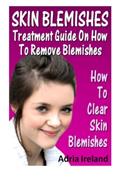 Read Skin Blemishes : Treatment Guide On How To Remove Blemishes: How To Clear Skin Blemishes, written by Adria Ireland Read Skin Blemishes : Treatment Guide On How To Remove Blemishes: How To Clear Skin Blemishes, written by Adria Ireland