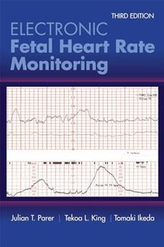 Electronic Fetal Heart Rate Monitoring: The 5-Tier System: The 5-Tier System, written by Julian T. Parer; Tekoa L. King; Tomoaki Ikeda